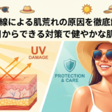 紫外線による肌荒れの原因を徹底解説。今日からできる対策で健やかな肌へ。