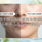 繰り返す肌荒れの原因を徹底解説。今日から始める改善策で美肌へ導く。